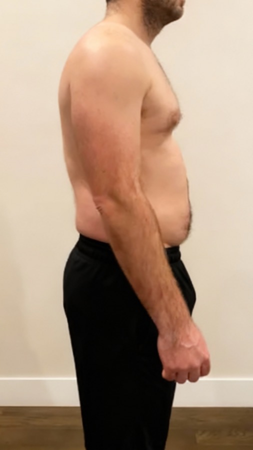 Client before